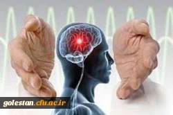 مسائل فرهنگی مهم ترین مانع پیشرفت درمان سکته مغزی در ایران 2