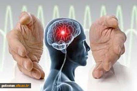 مسائل فرهنگی مهم ترین مانع پیشرفت درمان سکته مغزی در ایران 2